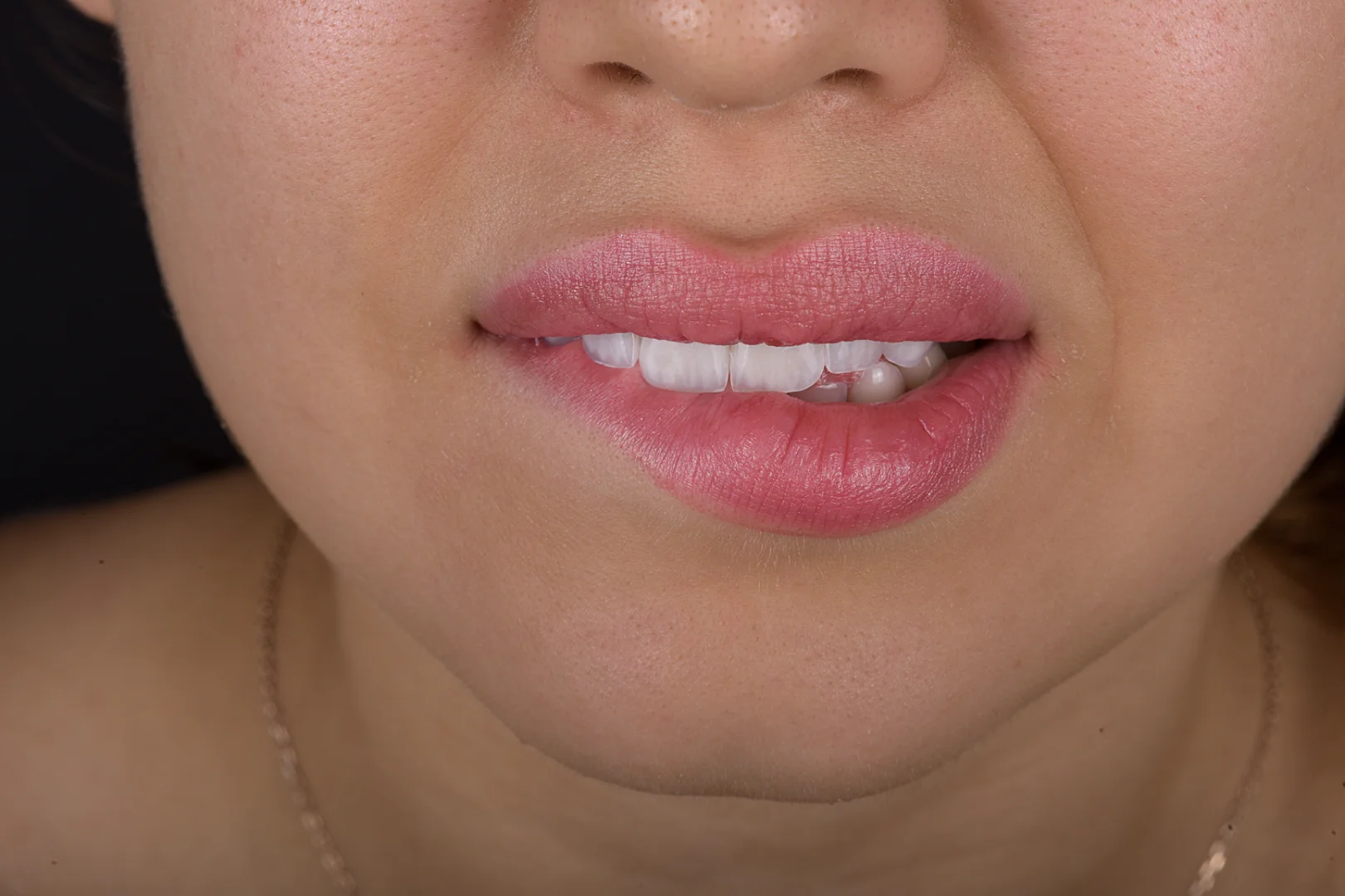 Dental Fotoğraf Çekimi