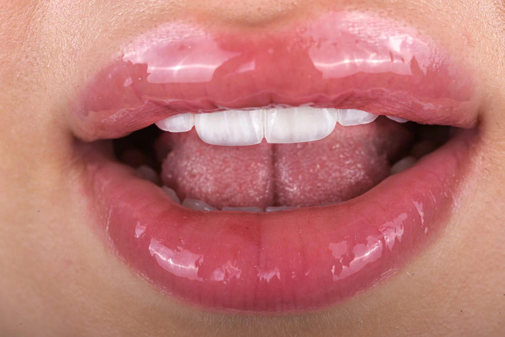 Dental Fotoğraf Çekimi