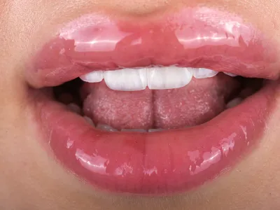 Dental Fotoğraf Çekimi - Görsel 1