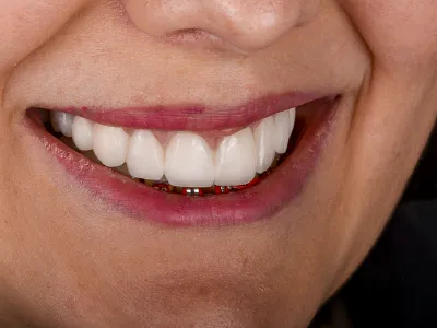 Dental Fotoğraf Çekimi - Görsel 4