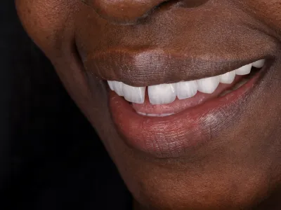 Dental Fotoğraf Çekimi - Görsel 5