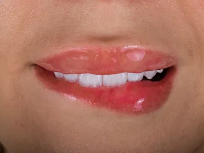 Dental Fotoğraf Çekimi - Görsel 6