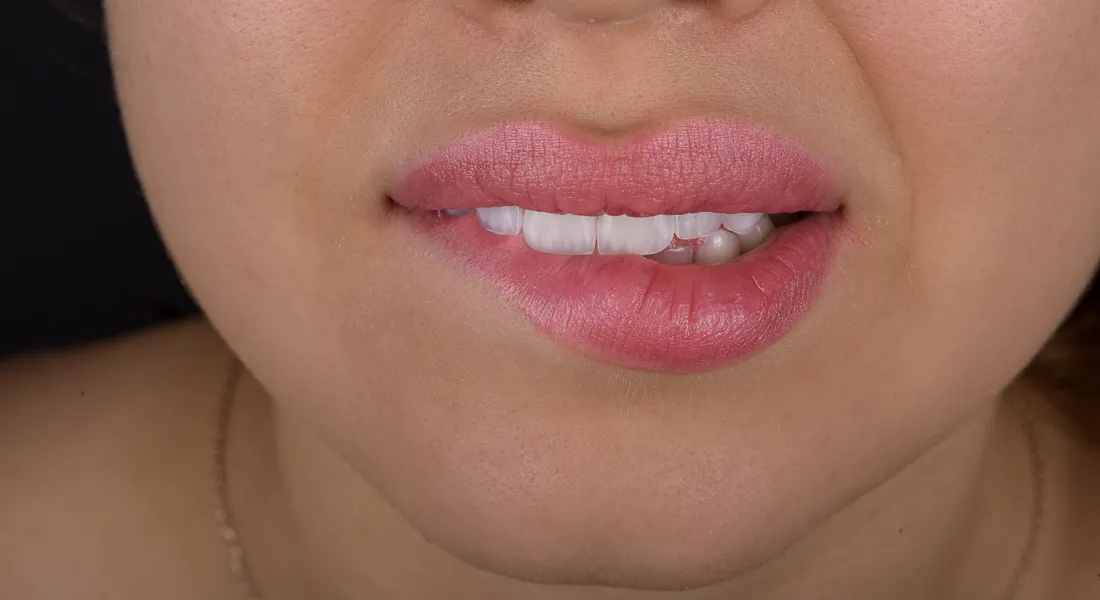 Dental Fotoğraf Çekimi