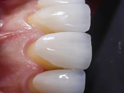 Dental Fotoğraf Çekimi - Görsel 9