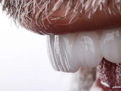 Gülüş Tasarımı - Görsel 1